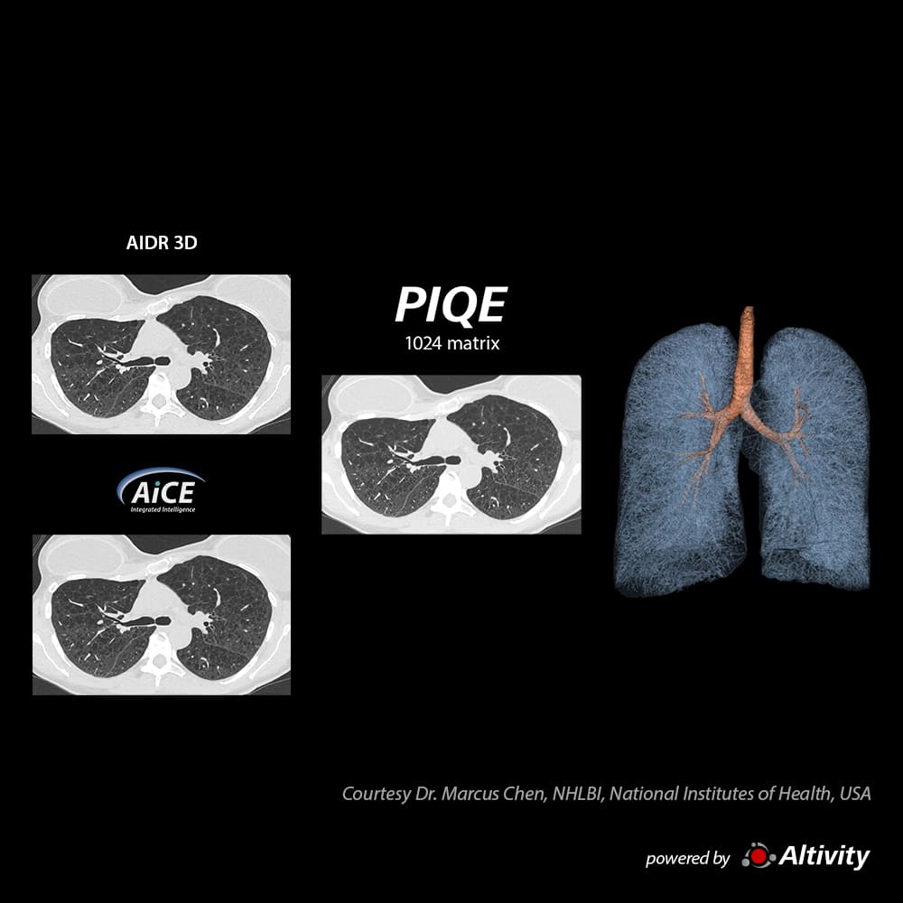 Precise IQ Engine Venous Phase