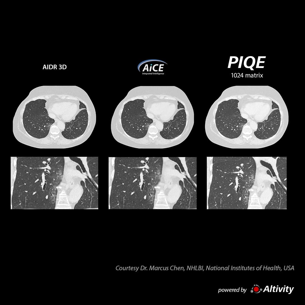 Precise IQ Engine Venous Phase