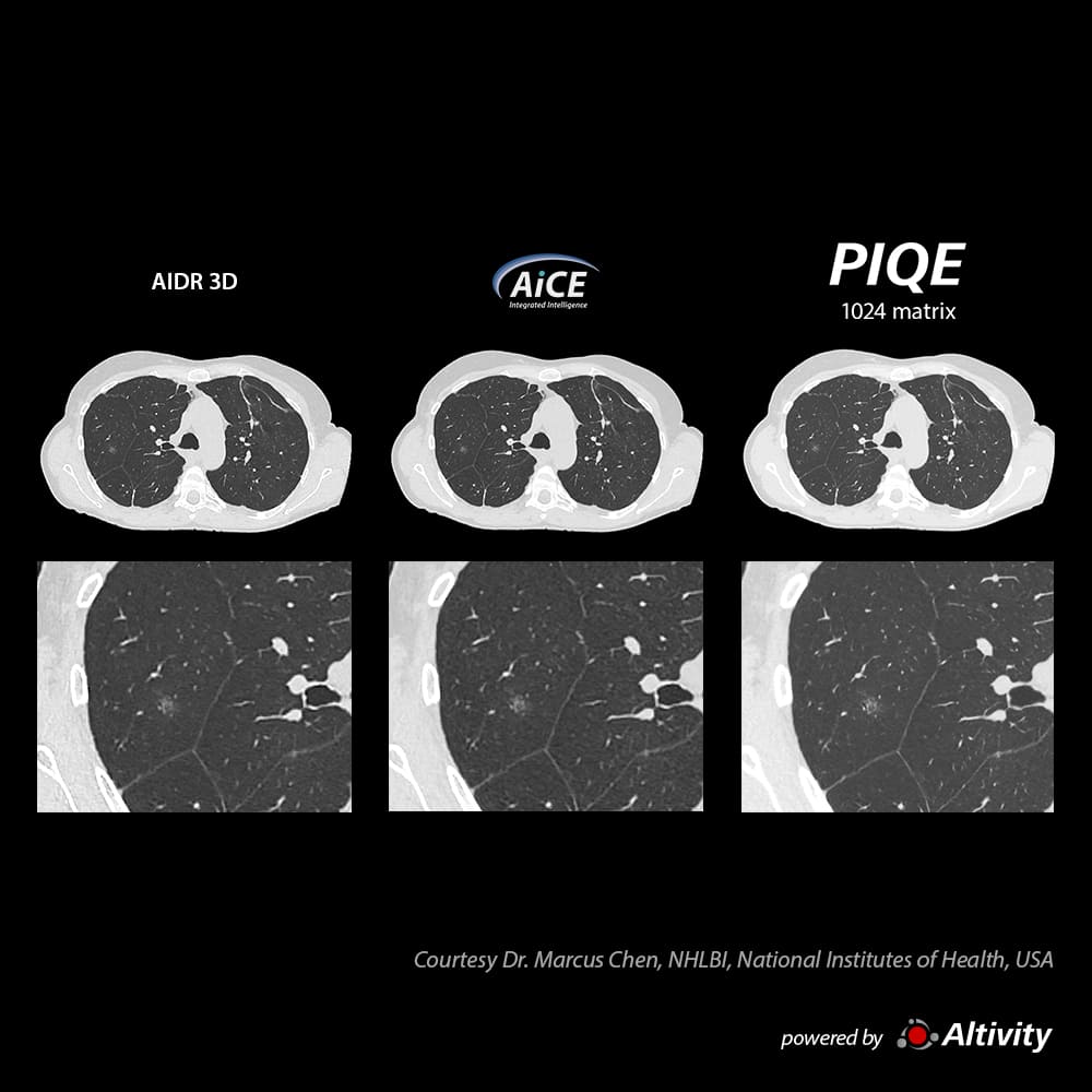 Precise IQ Engine Venous Phase
